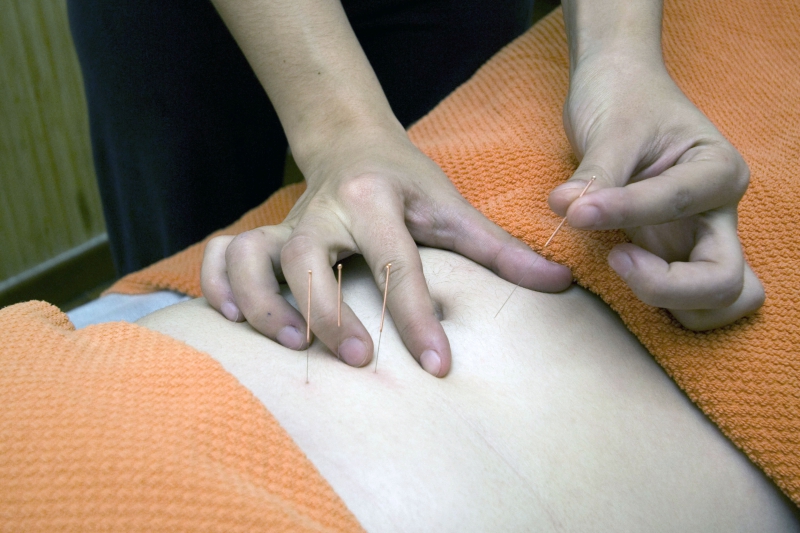 osteopathe-CHATEAUNEUF D ENTRAUNES-min_acupuncture-4175625